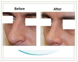 Slider image (3) Aesthetic Cosmetic Plastic Surgery Center Bolivia - SensualBodyDream